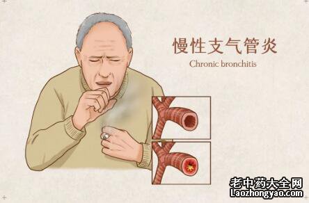 慢性支气管炎的饮食宜禁忌