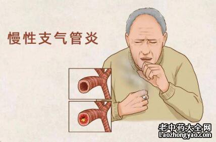 慢性支气管炎的饮食宜禁忌-食疗-吃什么好